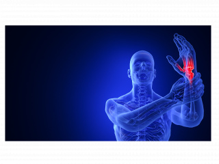 立体腕关节疾病C4D模型