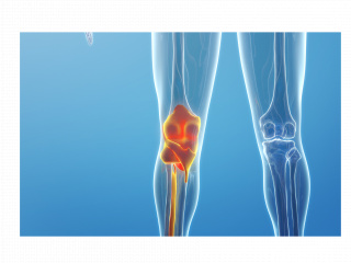 立体膝关节C4D模型