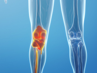立体膝关节C4D模型