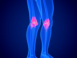 立体人体医疗膝盖疾病C4D模型